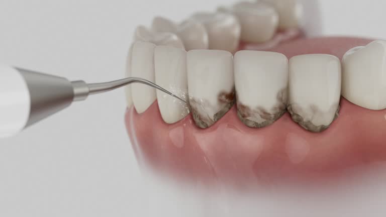 Trusted Emergency Dentist service in New Richmond, OH - Dentist Open Now